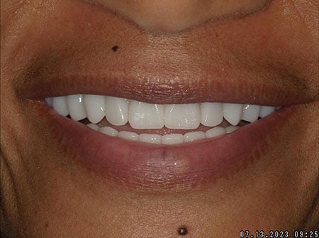 Dental Care of Baltimore Owings Mills photo 3