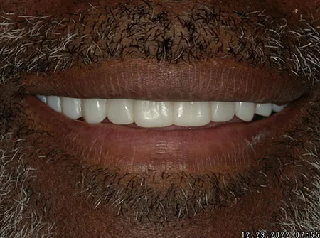 Dental Care of Baltimore Owings Mills photo 4 in Baltimore