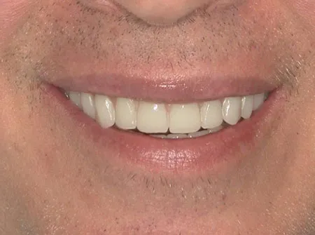 Dental Care of Baltimore Owings Mills photo 5 in Baltimore